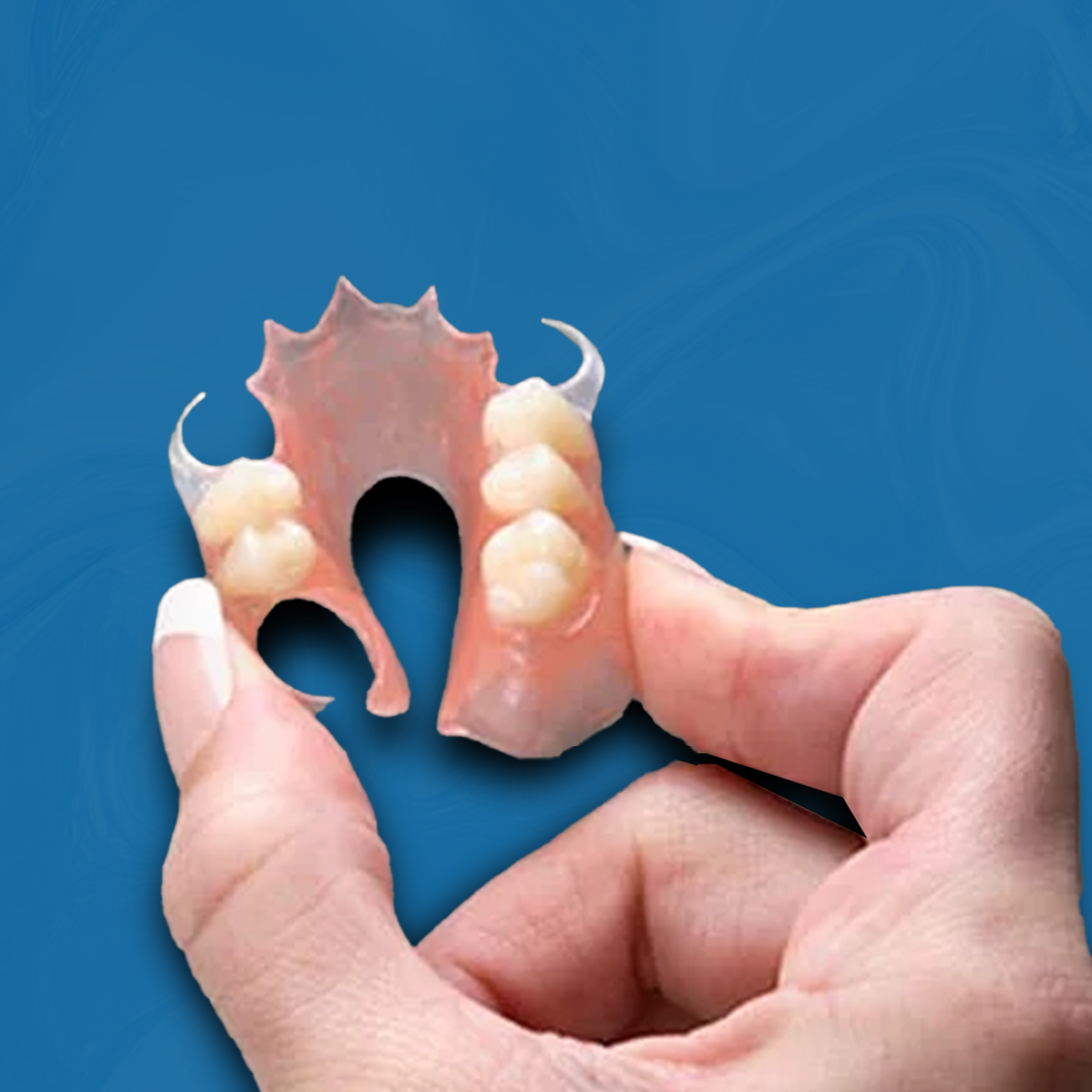 Flexible Dentures (1–3 Teeth)