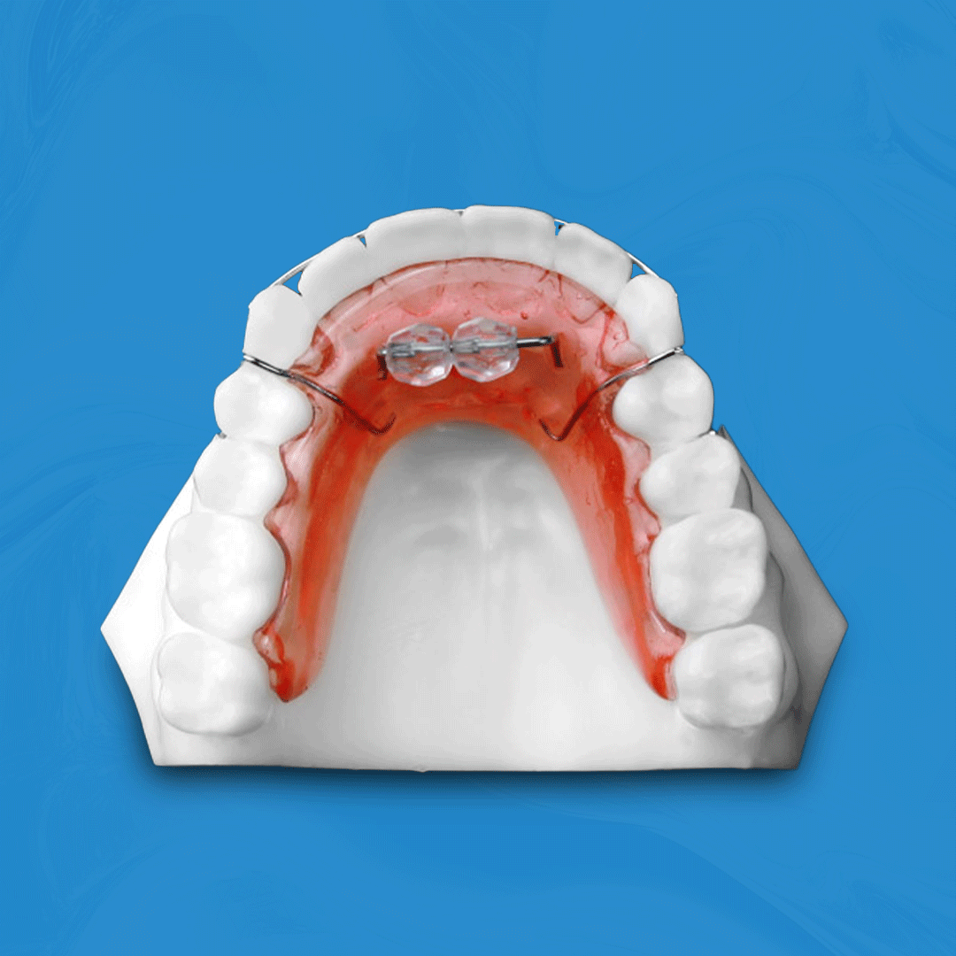 Removable Habit Breaker