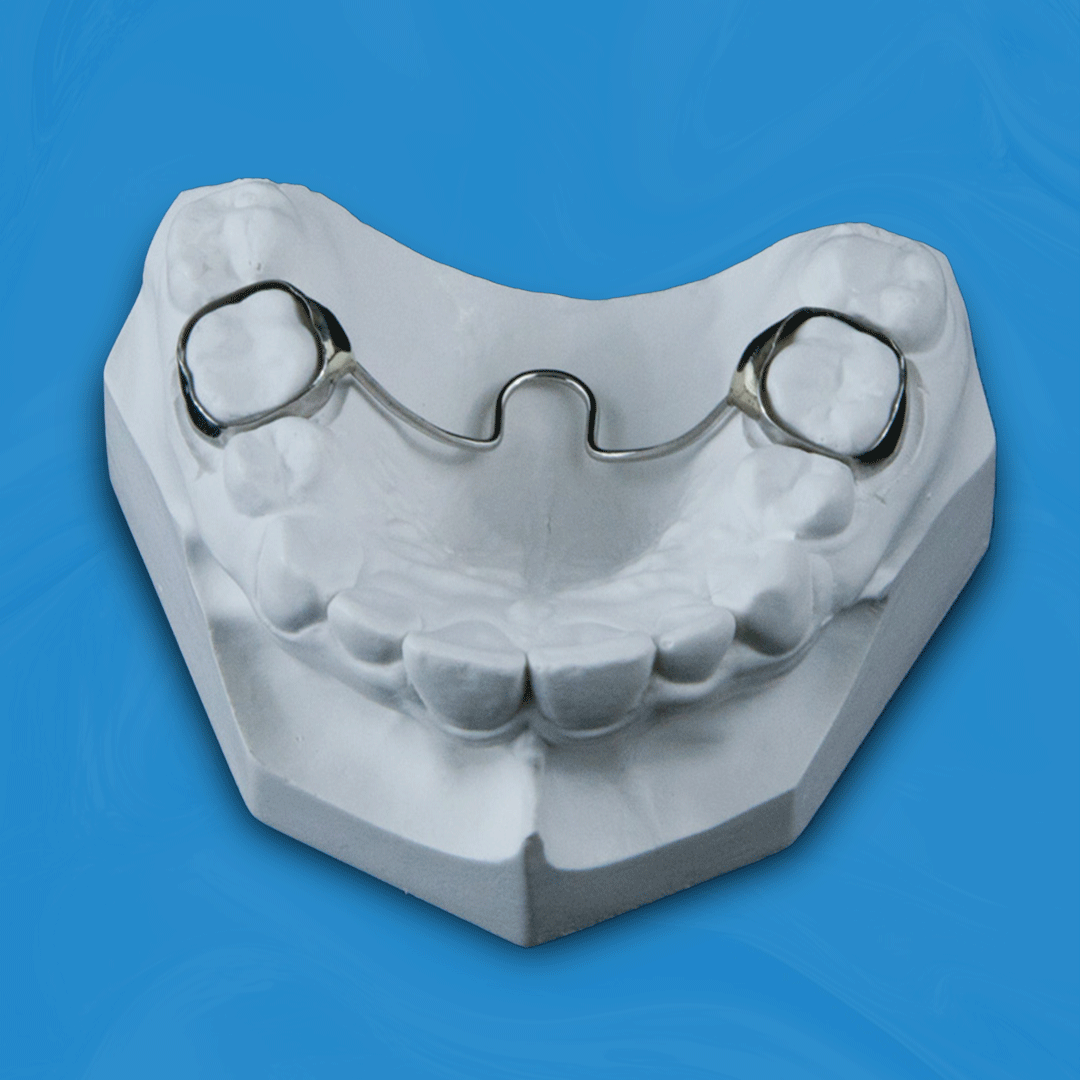 Palatal Arch
